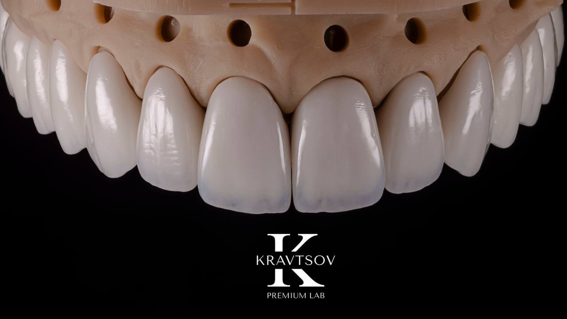 Кейс 3. Emax
