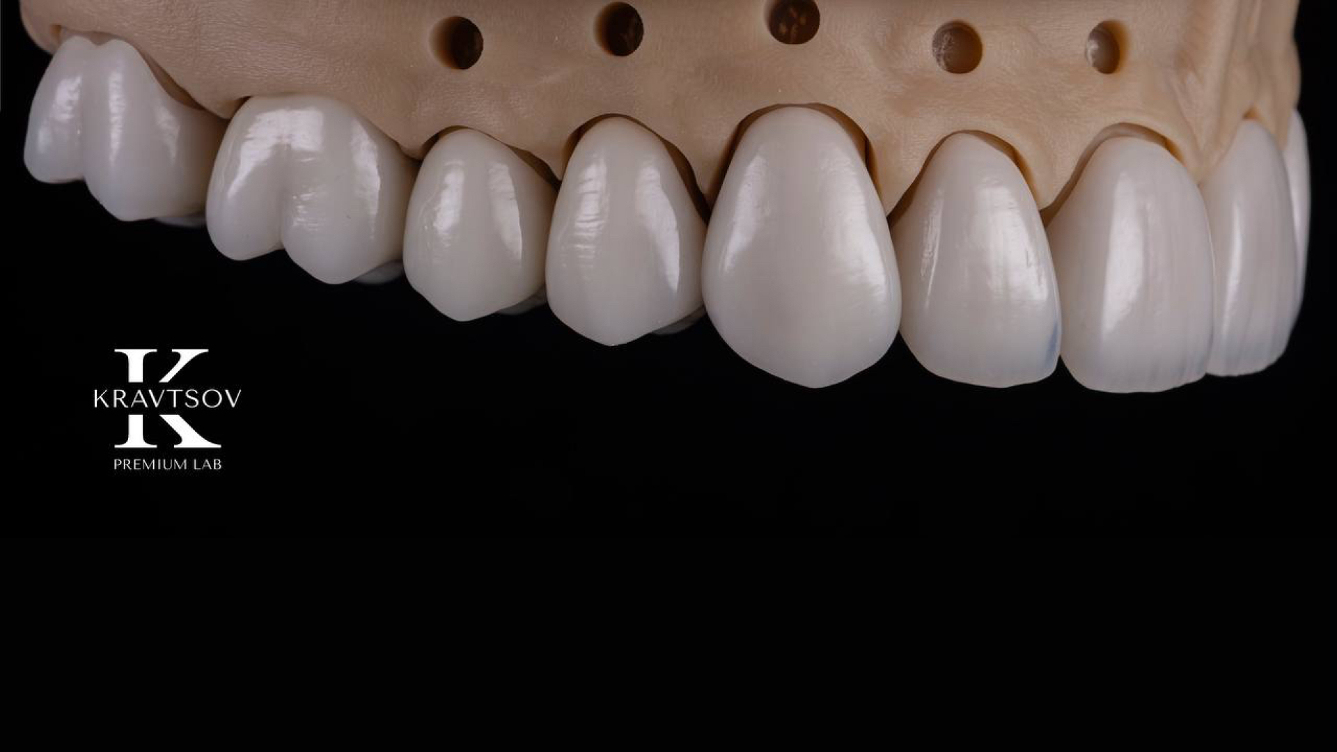 Кейс 6. Emax